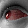 RedEye